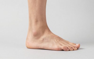 How to Choose Plantar Fasciitis Night Splints: What Actually Matters
